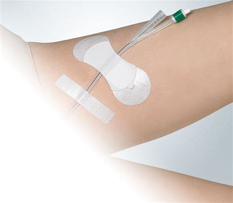 Фиксатор мочевого катетера - Grip Foley - ACE Medical - нога / клейкий