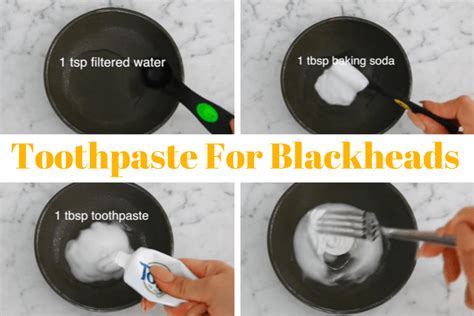 7 Diy Remedies To Get Rid Of Blackheads