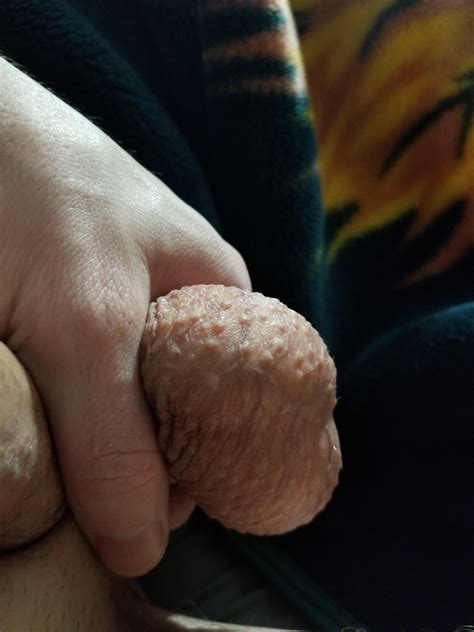 Toy Ass Solo Insertions Photo Album By Omegathad XVIDEOS