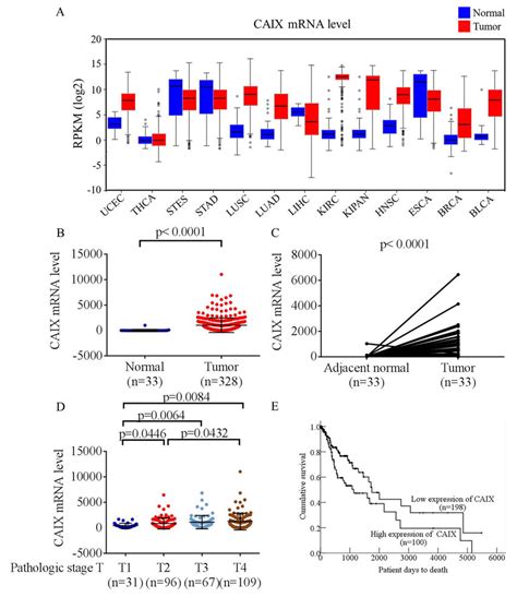 Analysis Of Caix Rna Expression In The Cancer Genome Atlas Tcga