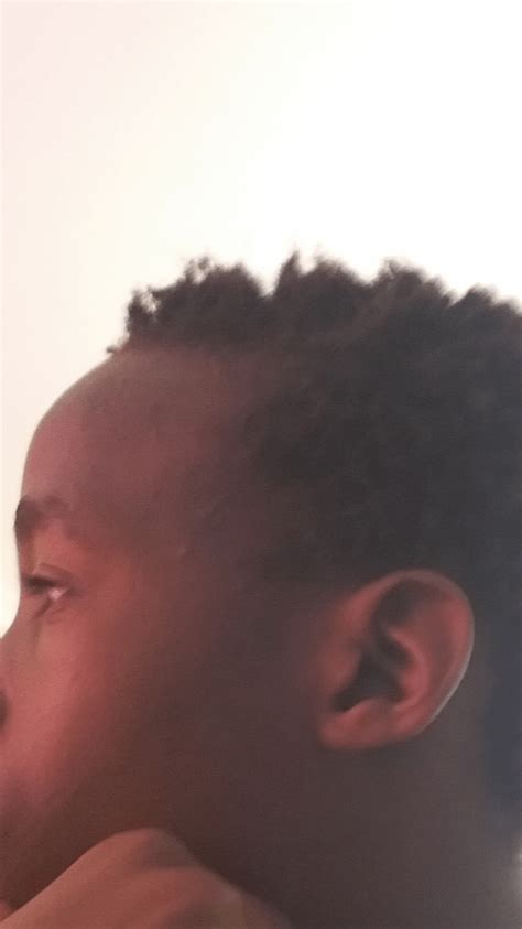 hairline   side naturally starts  farback