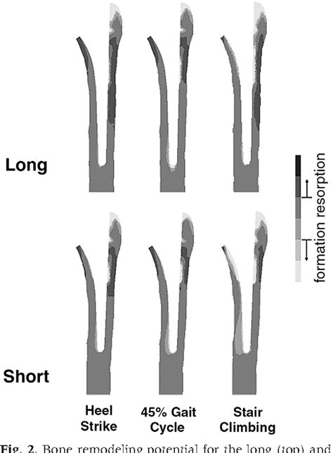 Figure From Biomechanical Comparison Of Proximally Coated Femoral