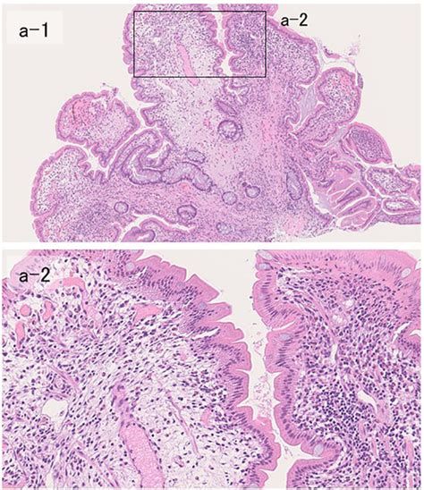 Histopathological Findings Of Biopsy Hande Staining The Lesion Download Scientific Diagram