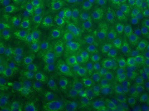 Best U Pinknpoppin Images On Pholder Labrats Micro Porn And Funkopop