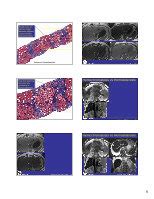 Pdf Radiologic Pathologic Correlation Of Liver Radiologic