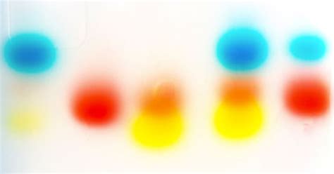 Gel Electrophoresis: Molecular Biology Science Activity | Exploratorium ...