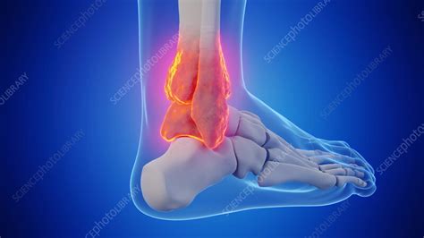 animation   bones   mans  ankle stock video clip