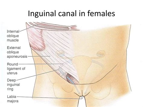 Surgical anatomy of the inguinal canal | PPTX
