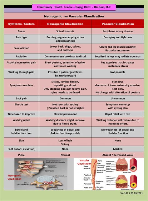 Medical Notes For Students: Neurogenic vs Vascular Claudication