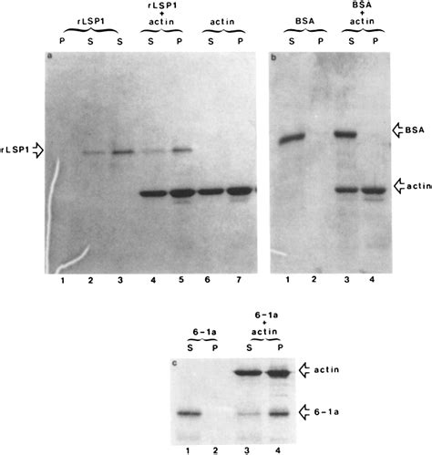 RLSP1 Binds To F Actin F Actin Binding Assay Of RLSP1 BSA And 6 1a