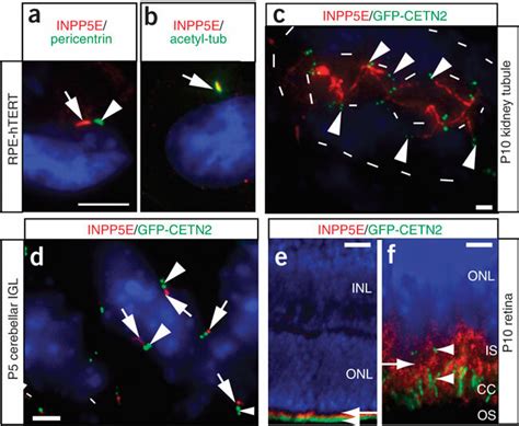 Ciliary Axonemal Localization Of Inpp5e A Rpe Htert Ciliated Cells Download Scientific