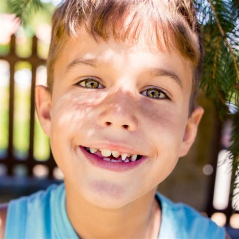 When does my child need braces? - Dr. Sep's London Ontario Practice