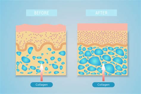 Clearing The Confusion About The Types Of Collagen Suzy Cohen Rph