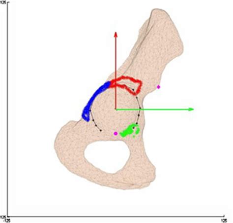 Ischiofemoral Ligament Cadaver