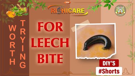 Leech Bite Home Remedy For The Same YouTube