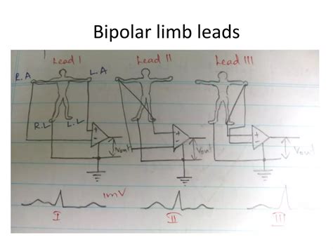 ecg lead configuration
