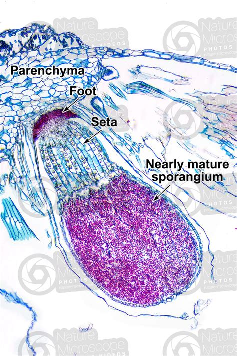 Marchantia polymorpha. Common liverwort. Sporophyte. Longitudinal section. 64X - Sporophyte ...