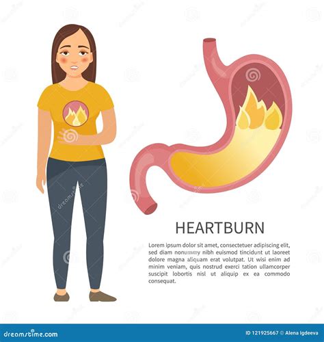 Infographics Of Gastritis Vector Illustration | CartoonDealer.com
