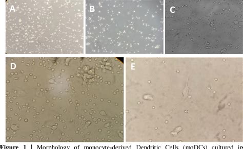 Figure 1 From MONOCYTE DERIVED DENDRITIC CELLS ISOLATION AND PHENOTYPIC