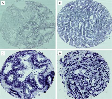 Mirna Expression By Lna Based In Situ Hybridization A Low Levels Of