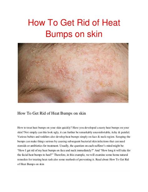 How to get rid of heat bumps on skinpdf2