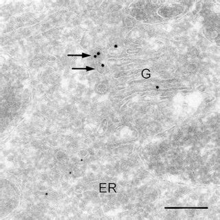 Vsv Gts Gfp Nm Gold Is Present In Golgi Cisternae Of