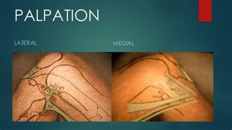 Ps Session Examination Of Knee Joint