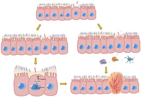 Frontiers Fusobacterium And Colorectal Cancer