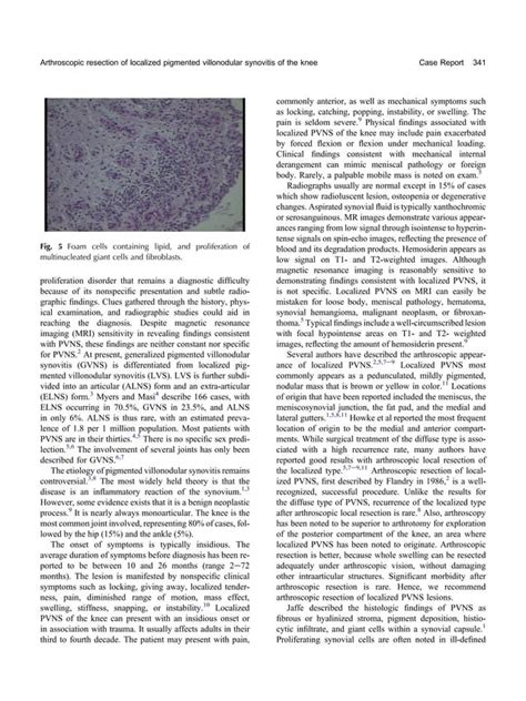 Arthroscopic Resection Of Localized Pigmented Villonodular Synovitis Of