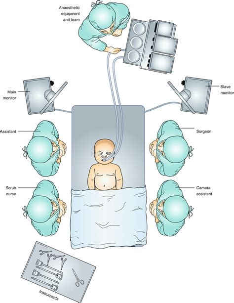 Laparoscopic Cholecystectomy Thoracic Key