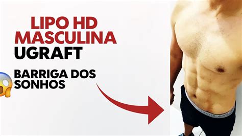 Antes E Depois Lipo Hd Masculina Lipo Hd Ugraft Youtube