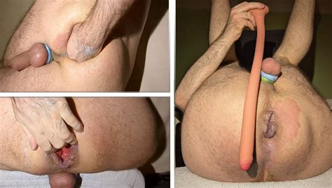 Hard Self Fisting And Deep Penetration Attempt Polish Gay Porn XHamster