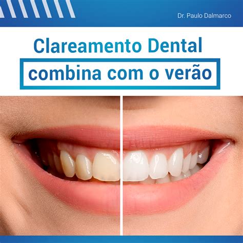 Pin de Roberta Manjabosco Pilau em Odonto Dentistas Saúde bucal