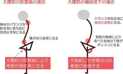 65歳上の高齢者の腰痛に腸腰筋ストレッチが効果的な理由 足腰を強くする高齢者の筋トレまとめ