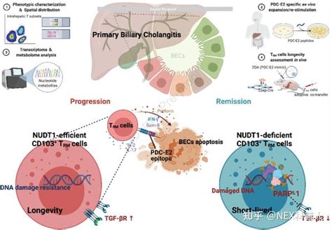 原发性胆汁性胆管炎的潜在治疗新靶点 知乎