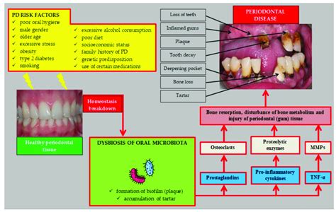 Personal Social Systemic And Local Risk Factors Associated With Oral