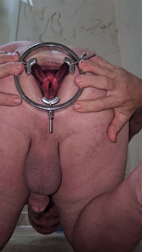 Anal Dilation And Destruction Pics Xhamster