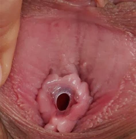 Extreme Closeup Of A Girl S Hymen Cherry Porn Pic