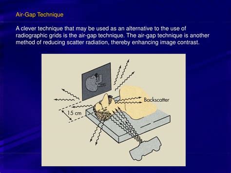 Ppt Radiographic Grids I Powerpoint Presentation Free Download Id