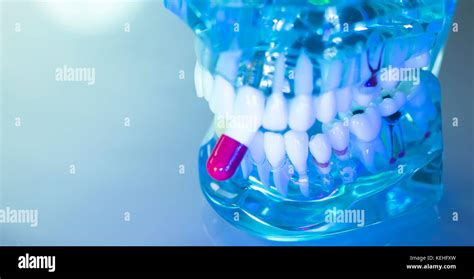 Dental Teeth Mouth Gums Dentists Teaching Model Showing Each Tooth