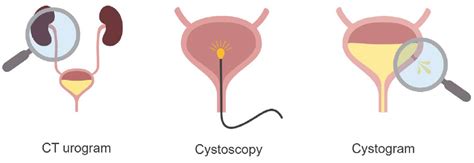 Abdominal Ct Cystogram • Litfl • Radiology Library