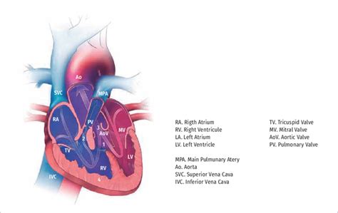 Tetralogy Of Fallot Q213 Download Scientific Diagram