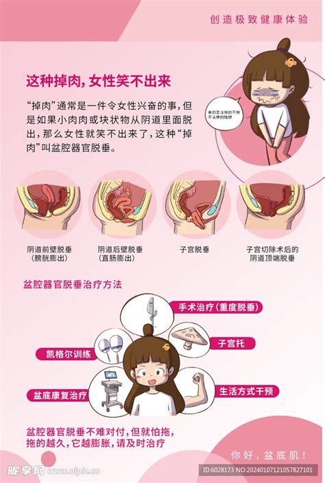 盆腔器官脱垂治疗方法 设计图海报设计广告设计设计图库昵图网