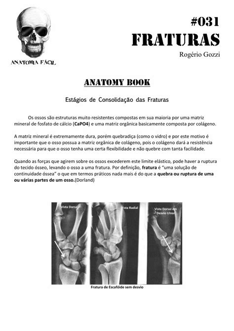 PDF 031 Anatomy Book Estágios de Consolidação Das Fraturas