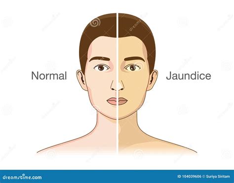 normal skin layer stock photography cartoondealercom
