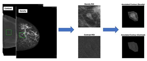 Diagnostics Free Full Text Predicting Malignancy Of Breast Imaging