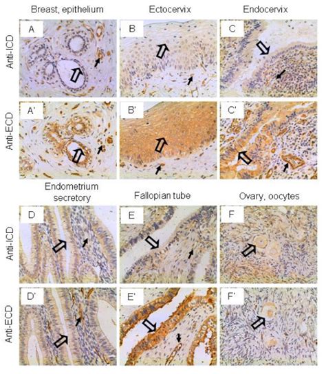 Il 17rc Expression In The Breast And Female Reproductive System