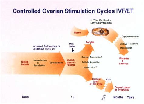 What Is Art And Ivf At Shirley Mead Blog