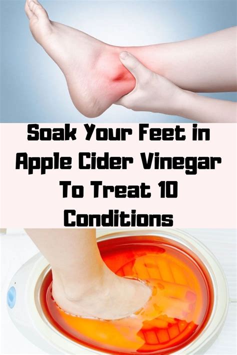 Soak Your Feet In Apple Cider Vinegar To Treat 10 Conditions