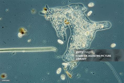 Pseudopodia Formation Of Amoeba Protozoan Seen Under A Microscope Nachrichtenfoto Getty Images